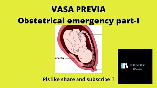 VASA PREVIA /Obstetrical emergencies | Part -I