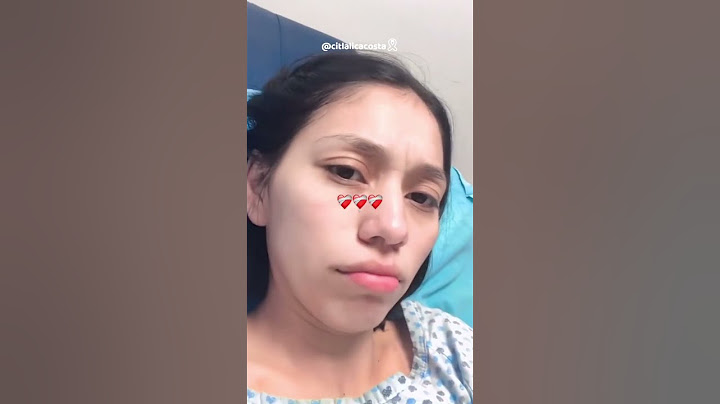 CAIDA de Cabello por Cancer de Mamá #cancer