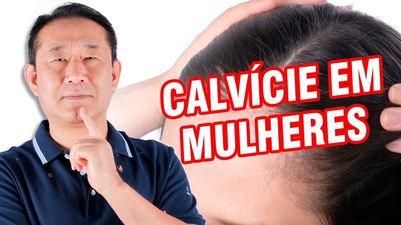 Alopécia androgênica femeninia medicina chinesa acupuntura