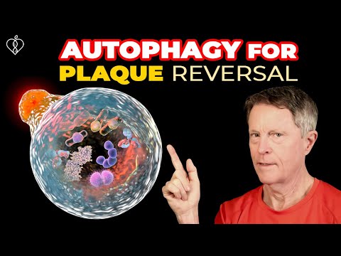 Reversing Arterial Plaque With Autophagy (part 1)