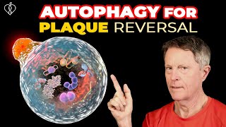 Reversing Arterial Plaque With Autophagy (part 1) screenshot 4