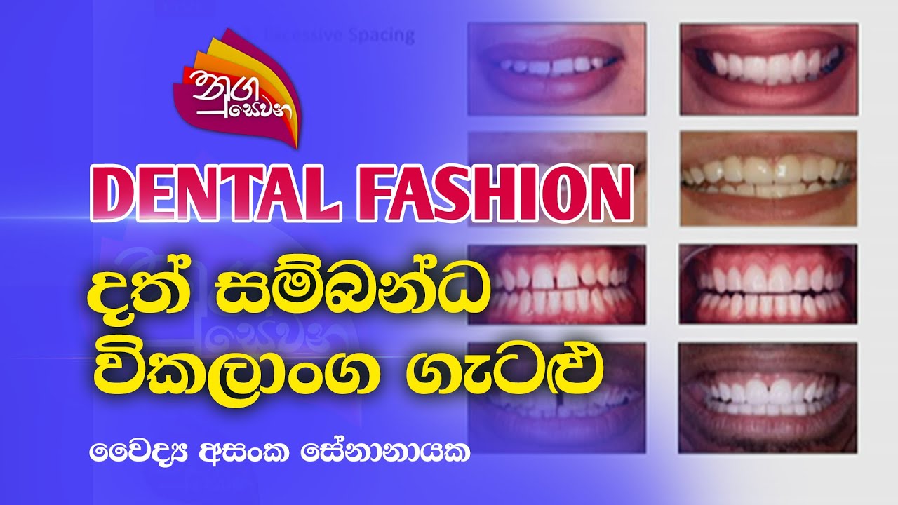 Nugasewana |DENTAL FASHION -දත් සම්බන්ධ විකලාංග ගැටළු  2023-07-20 |Rupavahini