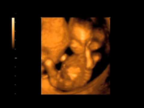 15 Weeks Pregnant 4d Ultrasound Gender - pixaby