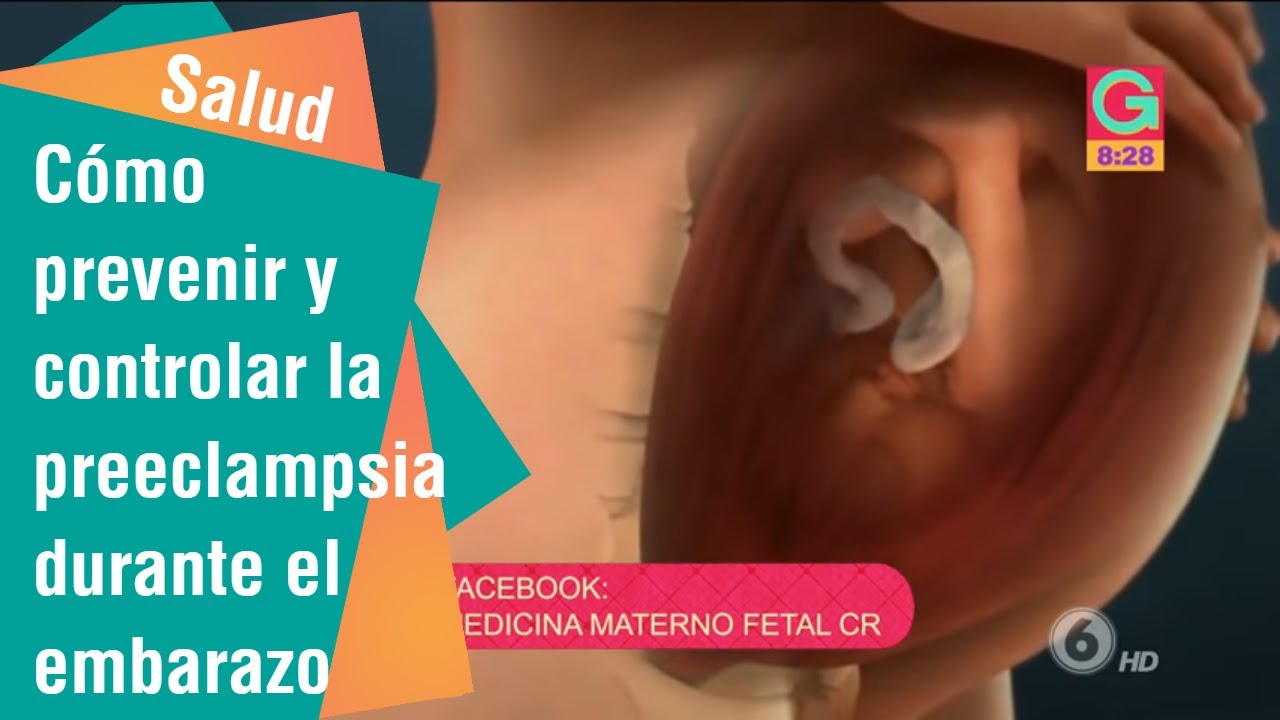 Cómo Prevenir Y Controlar La Preeclampsia Durante El Embarazo