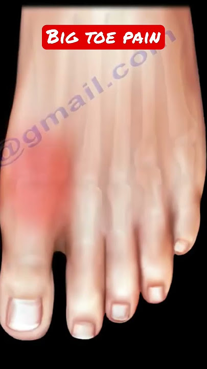 Big toe pain