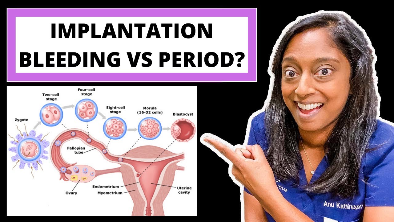 implantation bleeding vs period