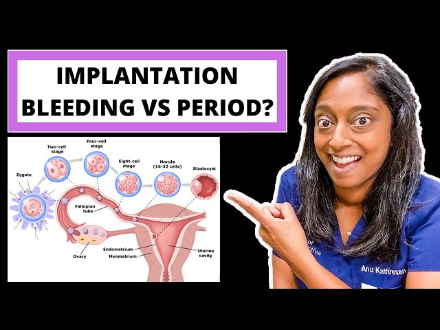 IMPLANTATION BLEEDING VS PERIOD: HOW TO TELL THE DIFFERENCE 