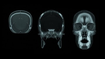 How to create a CT Scan Slice Animation in Blender