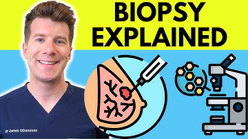 What is a Biopsy? Doctor explains procedure, purpose, results & more