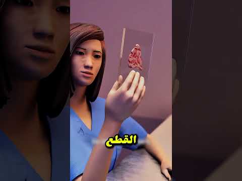 سر دماغ أينشتاين المفقود   