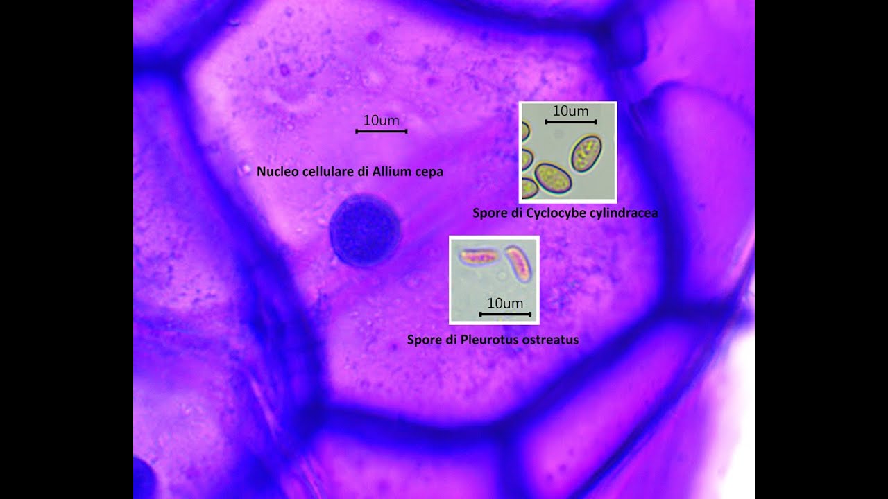 Cellule e nuclei di Allium cepa , la Cipolla, osservati al microscopio ottico YouTube Cellule e nuclei di Allium cepa , la Cipolla, osservati al microscopio ottico YouTube