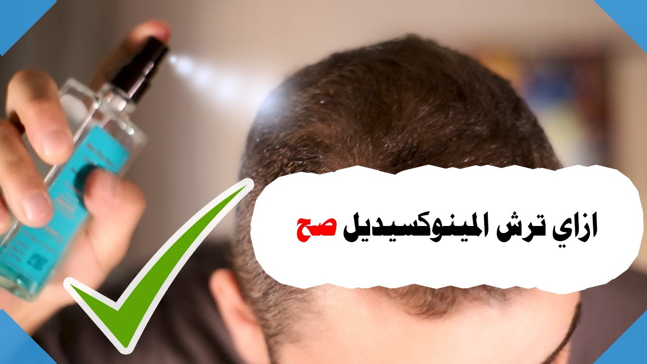 طريقة استعمال المينوكسيديل ازاي ترش المينوكسيديل صح على فروة راسك