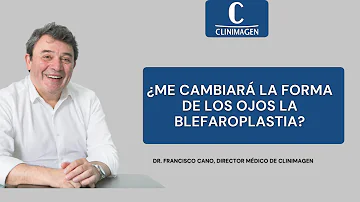 ¿Puede la blefaroplastia cambiar la forma de los ojos?