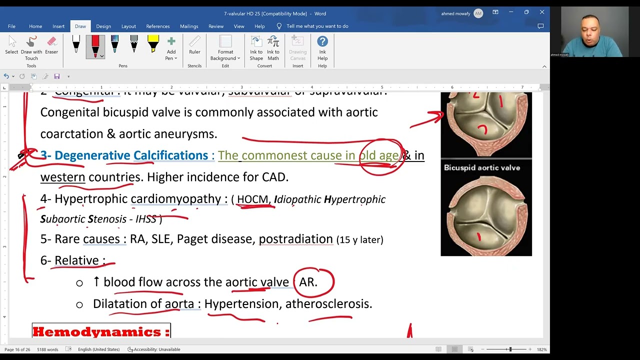 Aortic stenosis 2025