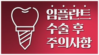임플란트 식립에 성공을 위한 길 