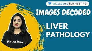 IMAGES DECODED | EPS 7 | LIVER PATHOLOGY | MUST KNOW IMAGES IN PATHOLOGY | DR. PREETI SHARMA