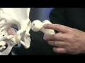 Alternatives To Hip Replacement Surgery Part 1