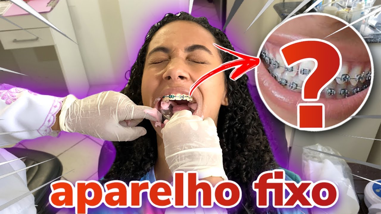 COLOQUEI APARELHO DE NOVO!