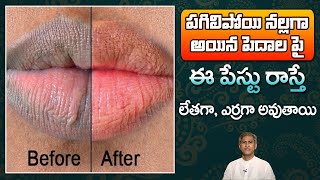 How to Treat Dark Lips | Get Soft Red Lips | Reduces Dry and Chapped Lips | Dr.Manthena's Beauty Tip screenshot 2