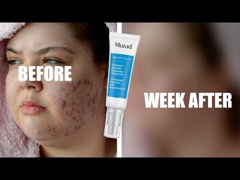 Video: Murad Clarifying Cleanser For Acne Review