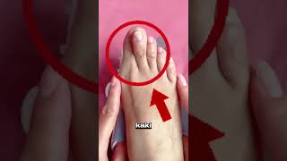 Sepatu Khusus Untuk Penderita Bunion
