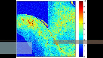 Laser Speckle Contrast Analysis for objectivating the Allen test (Nederlandse versie)