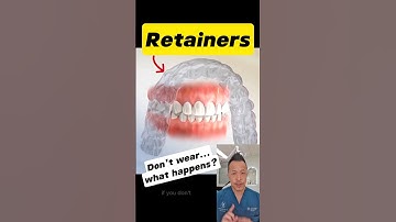 The Truth About Retainers: Why You Should Never Skip Them! #dentallan #dentist #shorts