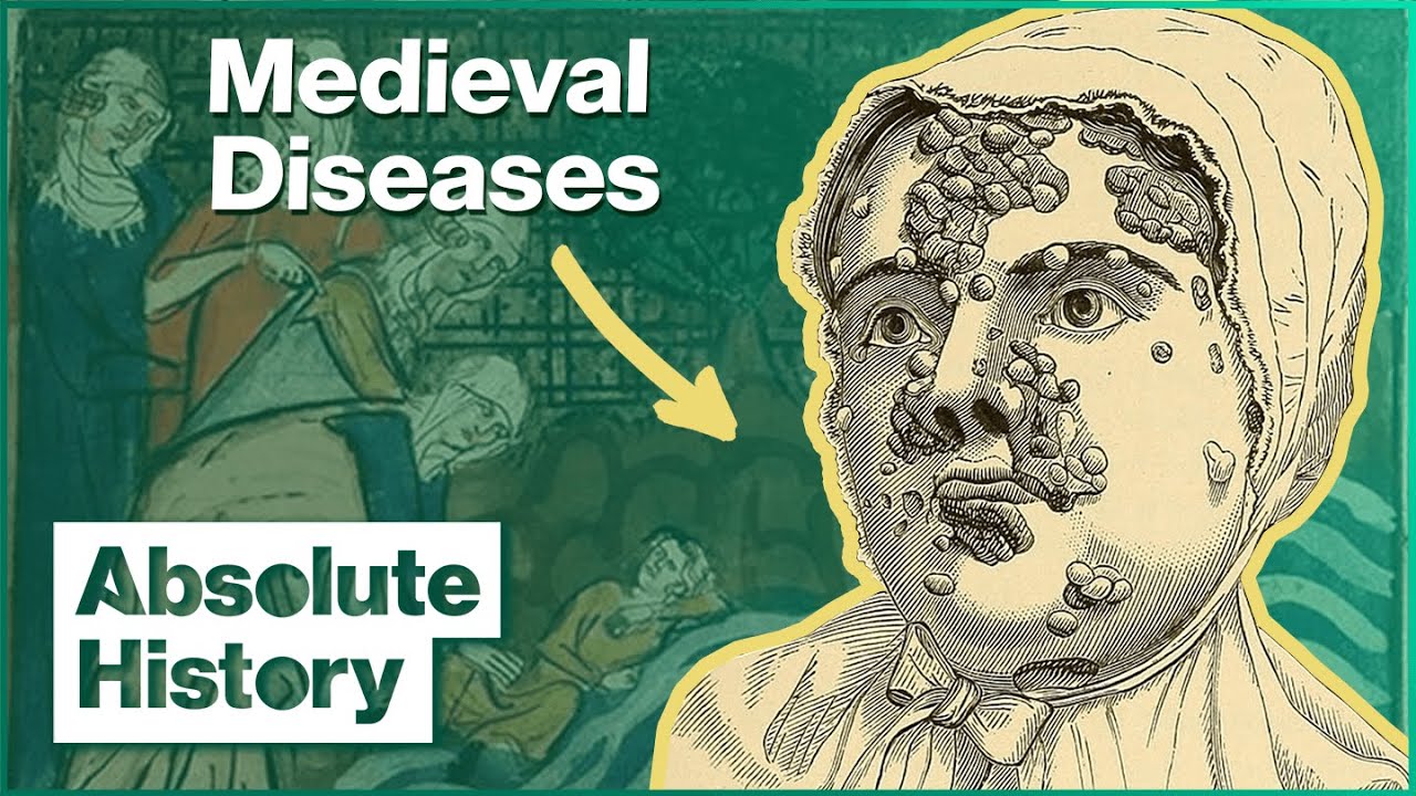 The Grim Realities Of Life Before Medicine | Medieval Dead | Absolute History