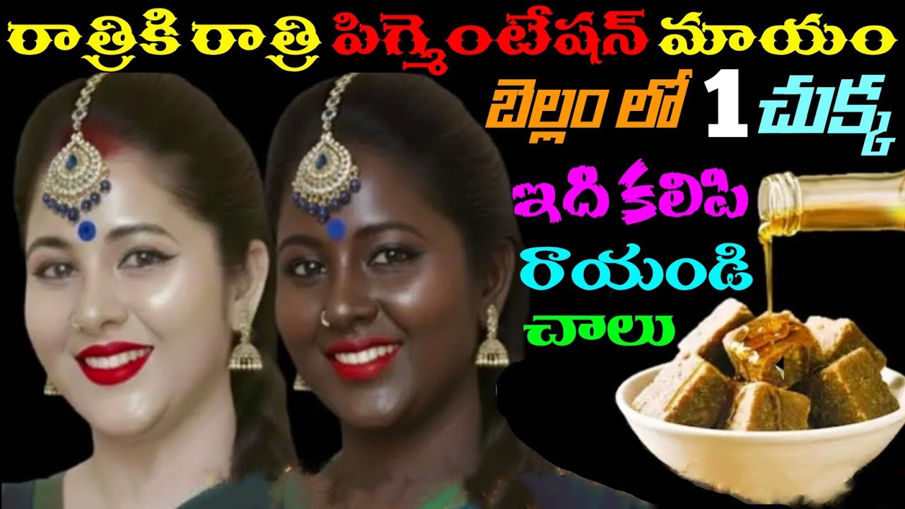 10 సంవత్సరాల పిగ్మెంటేషన్ ఒక్క రాత్రిలోనే తొలగిపోతుంది 👍ఒక్క చుక్క రాస్తే షాకింగ్ రిజల్ట్ చూస్తారు  