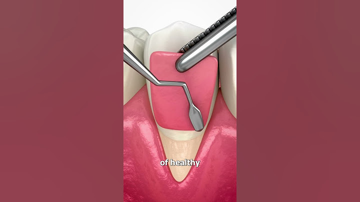 How They Fix Messed Up Gums 🦷