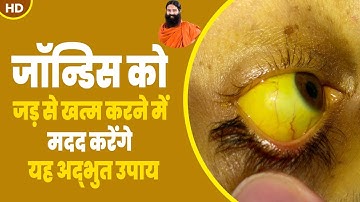 जॉन्डिस (Jaundice) को जड़ से खत्म करने में मदद करेंगे यह अद्भुत उपाय || Swami Ramdev