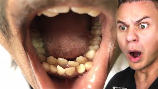 Orthodontist Reacts To The WEIRDEST Teeth On TikTok