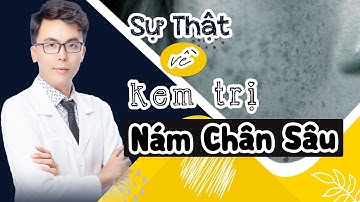 Bật Mí Sự Thật Gây Sốc Về KEM trị NÁM CHÂN SÂU để tránh lãng phí Tiền Bạc- Thời Gian và công sức