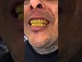 Whiten Teeth Naturally at Home | DIY Coconut Oil Toothpaste That Really Works! Teeth whitner At Home