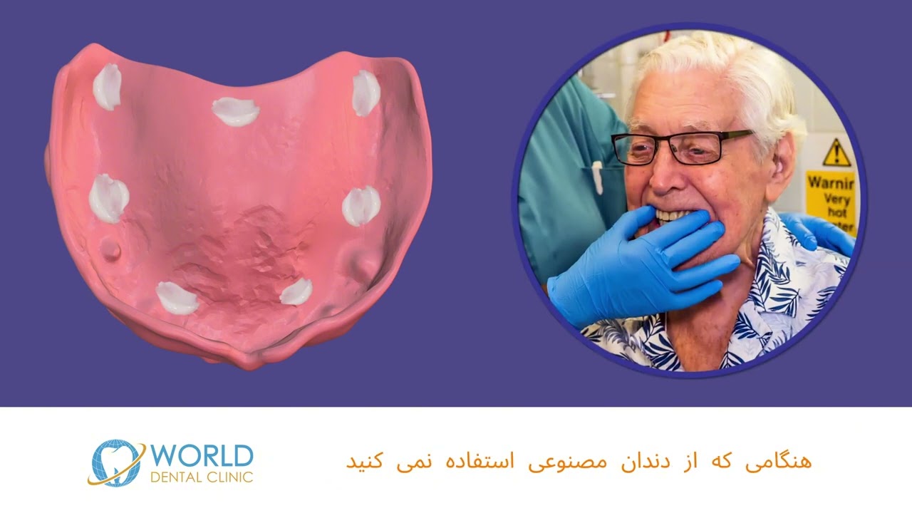 Proper Cleaning and Care for Your Dentures | World Dental Clinic Guide