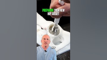 How Surgeons Prepare Your New Hip Socket: Acetabular Reaming Explained