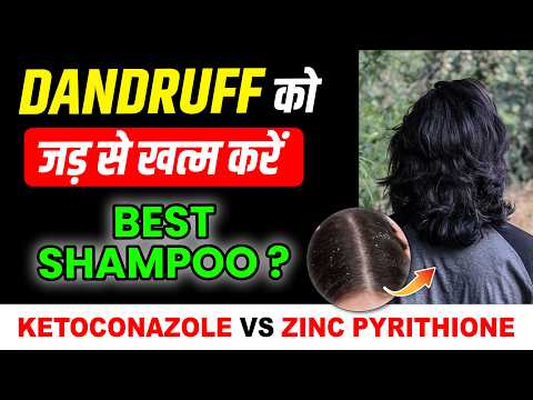 Dandruff झड़ना रोके | Best Shampoo for Dandruff | Ketoconazole & Zinc Pyrithione | Dandruff Solution