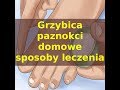 Grzybica Palców U Rąk Zdjęcia