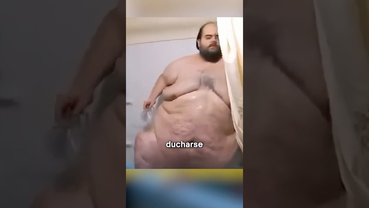 Asi es Vivir Pesando 362 kg