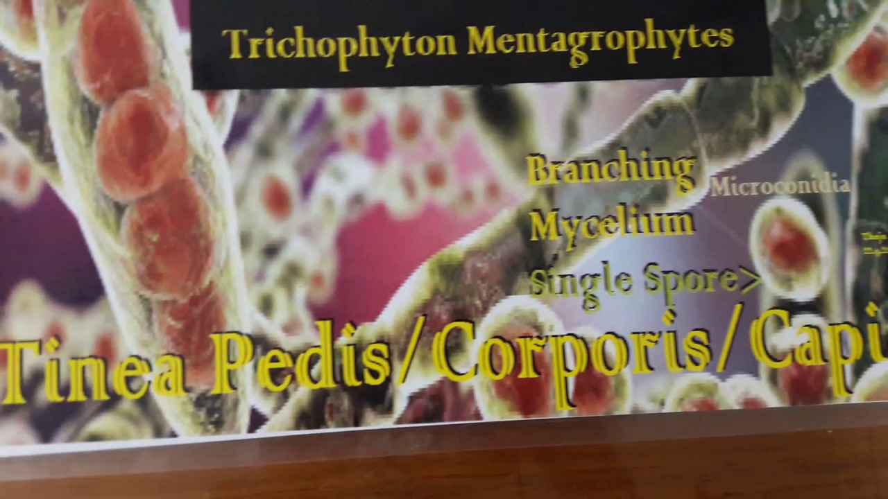 Lichenified Eczema + TineaPedis after 1st therapy YouTube