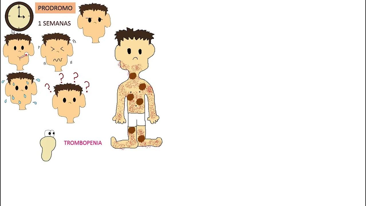 Rickettsia rickettsii YouTube