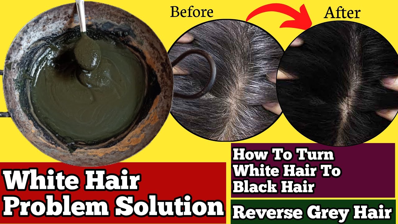 How To Get Rid Of White Hair Follow These Remedies  Updated 2023   Credihealth