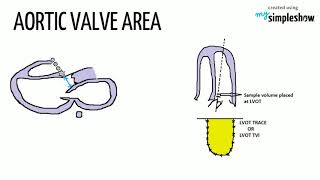 CONTINUITY EQUATION IN ECHOCARDIOGRAPHY-HEART AND TECHY