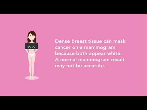  Do you know if you have dense breasts?