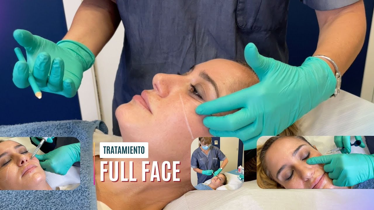 Tratamiento Full Face by Dra. Laura Salvador