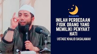 Ternyata Inilah perbedaan fisik orang yang memiliki penyakit hati-Ustadz Khalid Basalamah