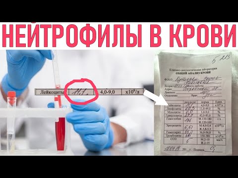 НЕЙТРОФИЛЫ В КРОВИ | Почему уровень нейтрофилов в крови повышен и что с этим делать