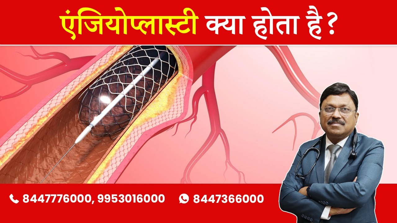 एंजियोप्लास्टी क्या होता है | What is Angioplasty | By Dr. Bimal Chhajer | Saaol