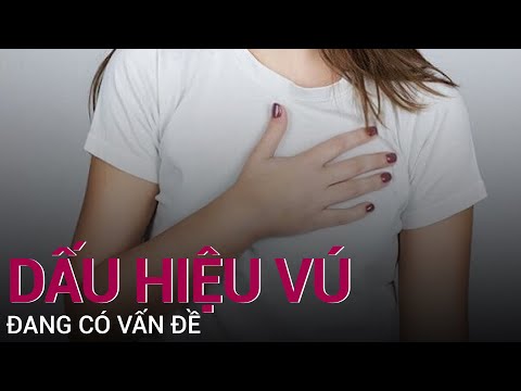 Video: Phụ lục tương đồng ở các động vật có vú khác Cấu trúc tương đồng biểu thị điều gì?