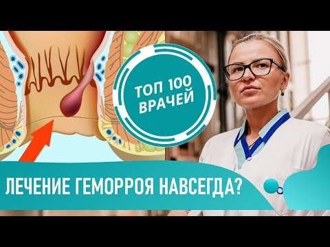 Лечение ГЕМОРРОЯ на 1-4 СТАДИИ. Как лечить геморрой у женщин и мужчин. Как избавиться от геморроя